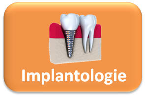 Implantologie